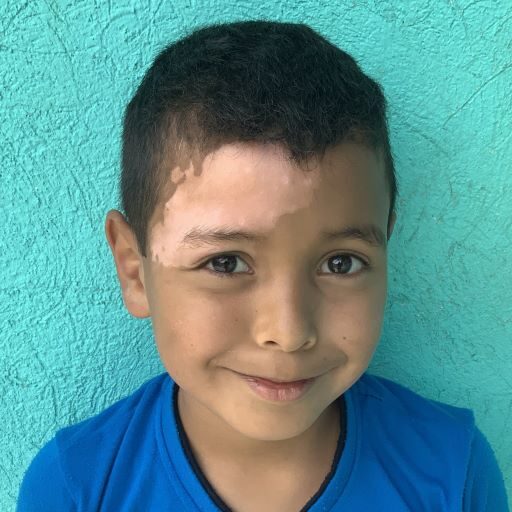 Gerson Antonio